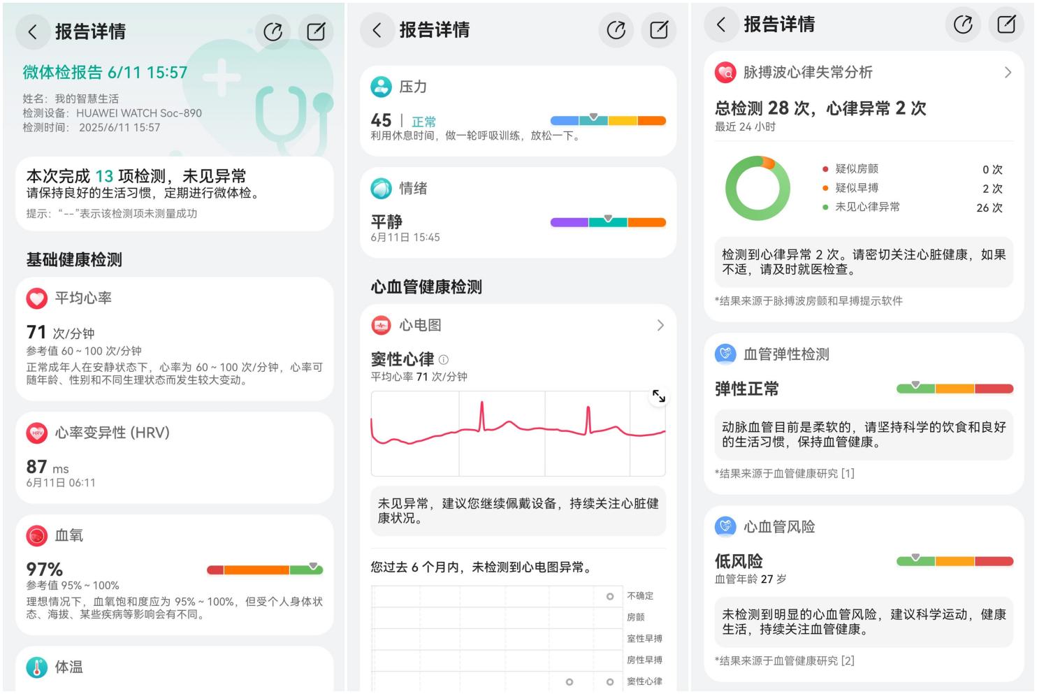 华为WATCH 5评测：首款鸿蒙AI+麒麟+5G智能手表 2025必入之选