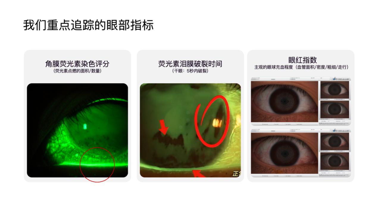 不止爸妈，手机厂商怎么也开始关心你的用眼健康了？